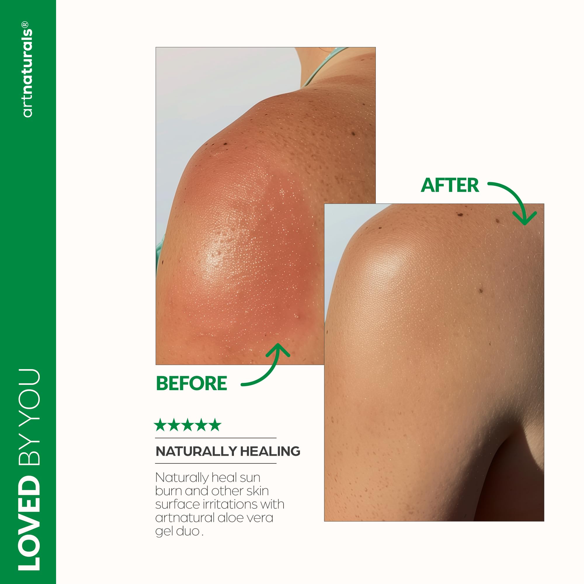 Artnaturals Duo Pack box emphasizes versatile aloe for home and travel.