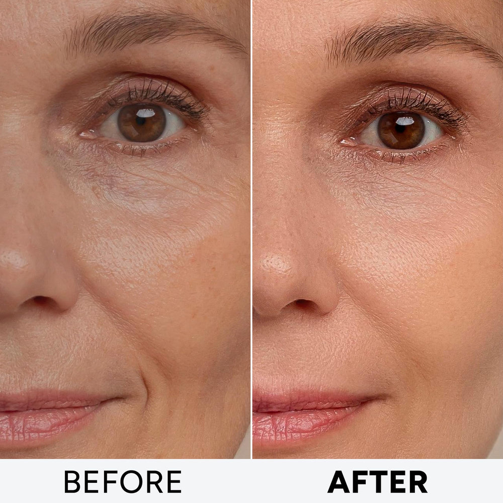 Arvesa crema retinol con ácido hialurónico, hidratación profunda