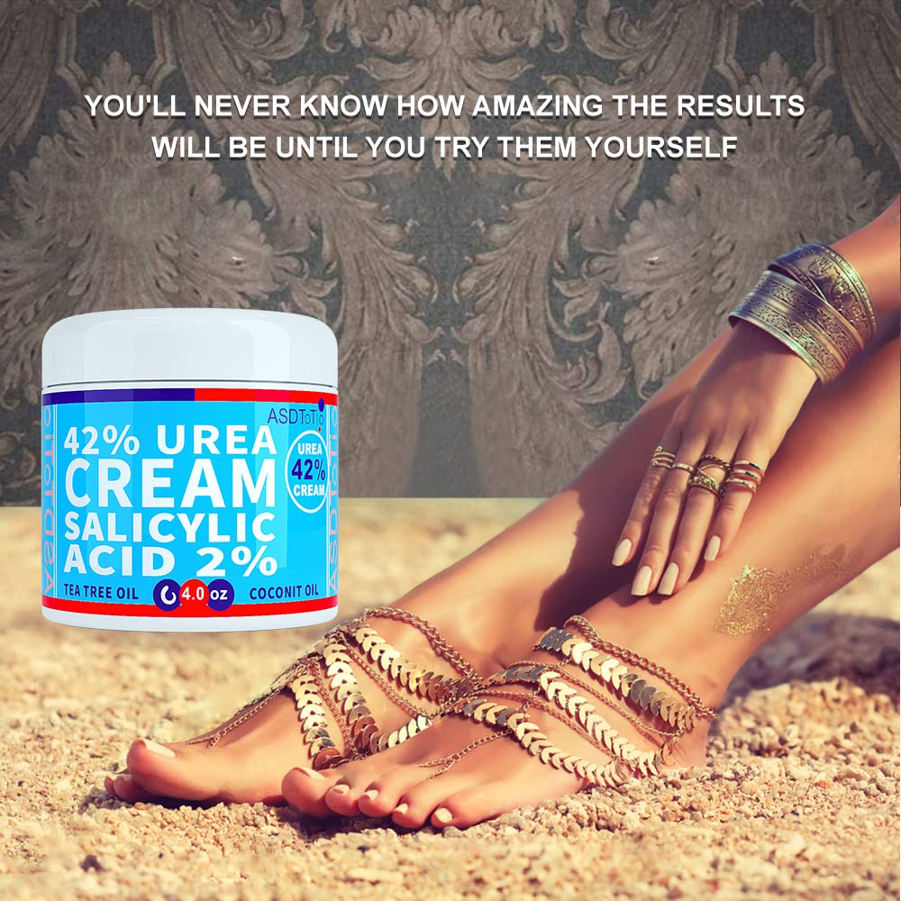 ASDToTio Urea Cream 42% application on heels and elbows provides targeted care