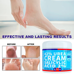 ASDToTio Urea Cream 42% packaging front view signals premium skincare