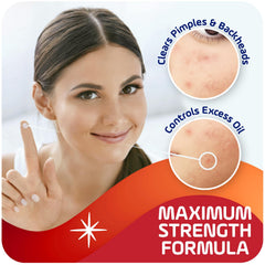 Asepxia formula seca que deja la piel sin residuo graso