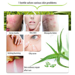 ASYBO Aloe Vera Gel moisturizes skin with a refreshing feel