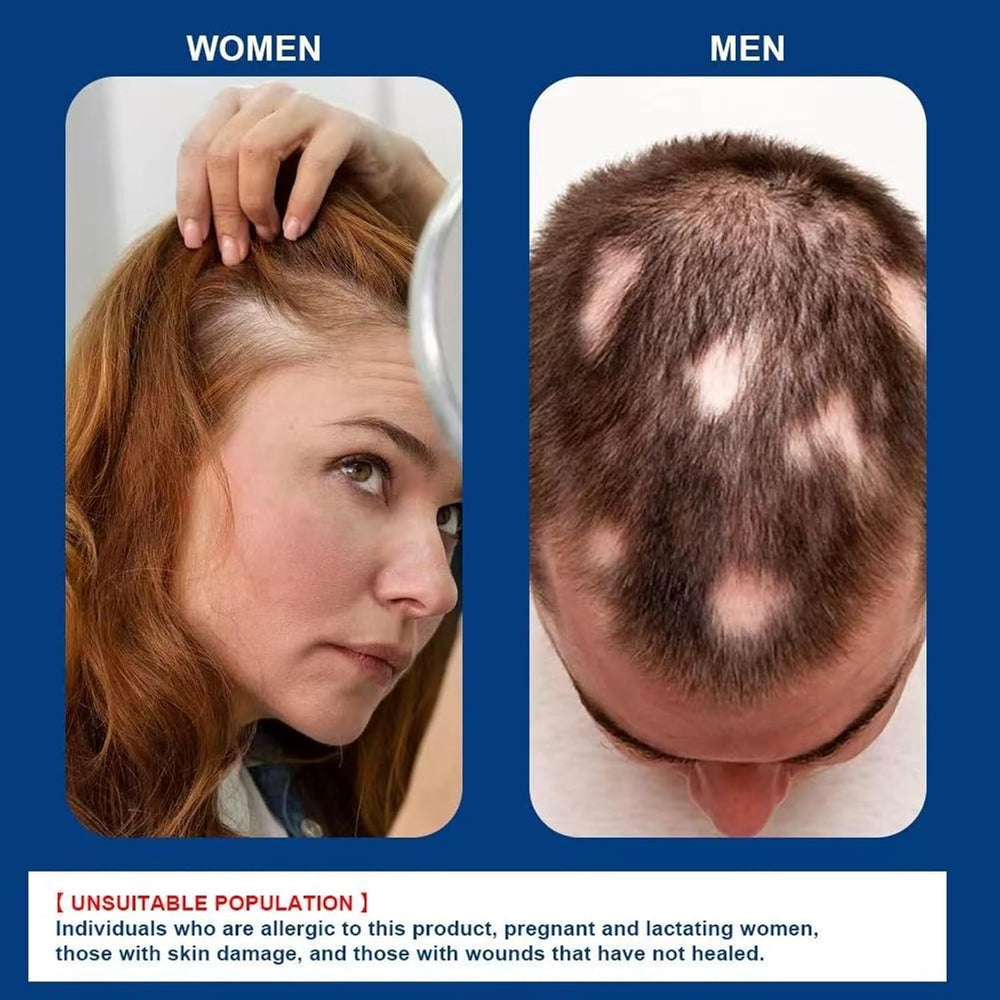 ATHNO Kormesic resultados de densidad y grosor en cabello y barba
