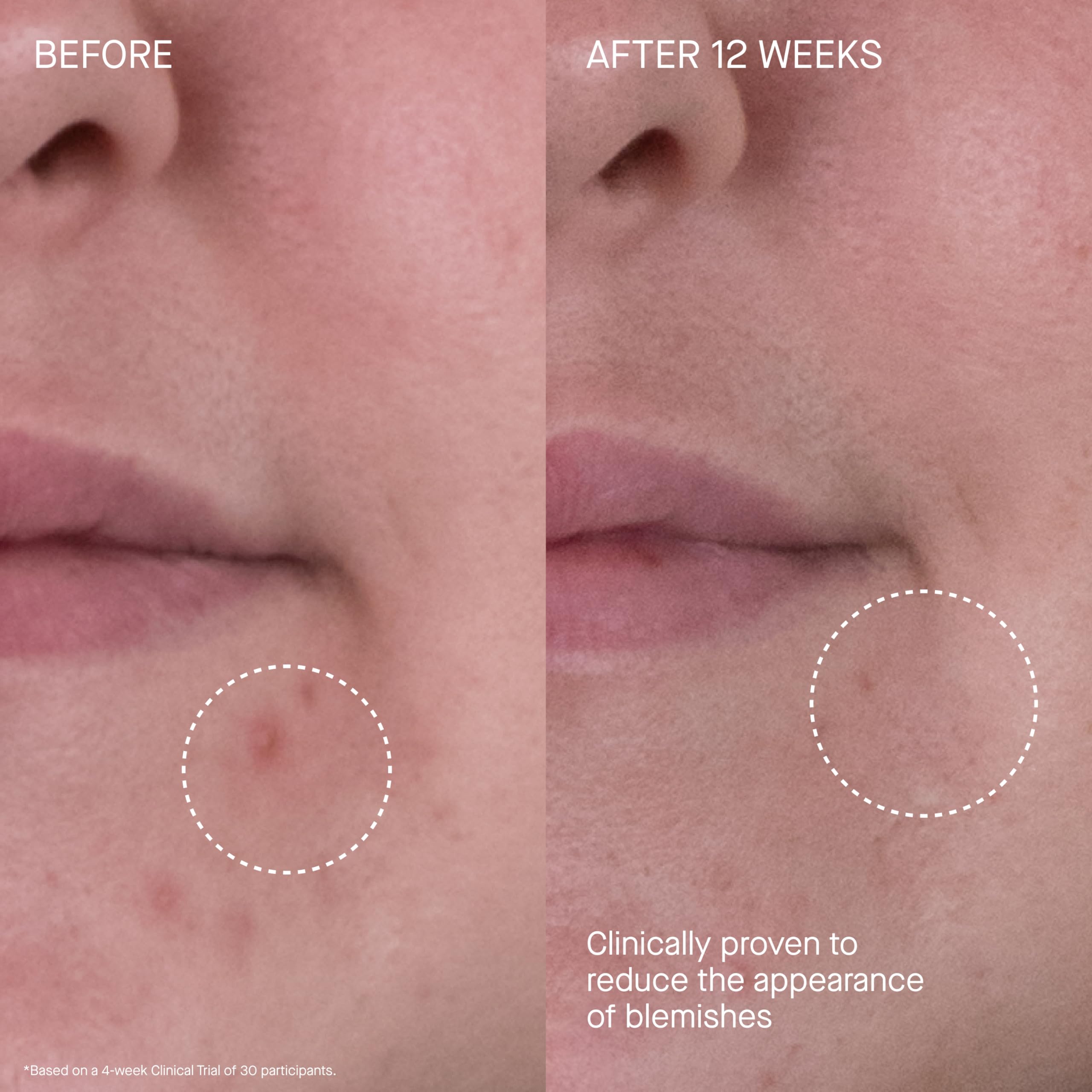 Morning routine with Rich Cream applied to face, neck, and décolleté.