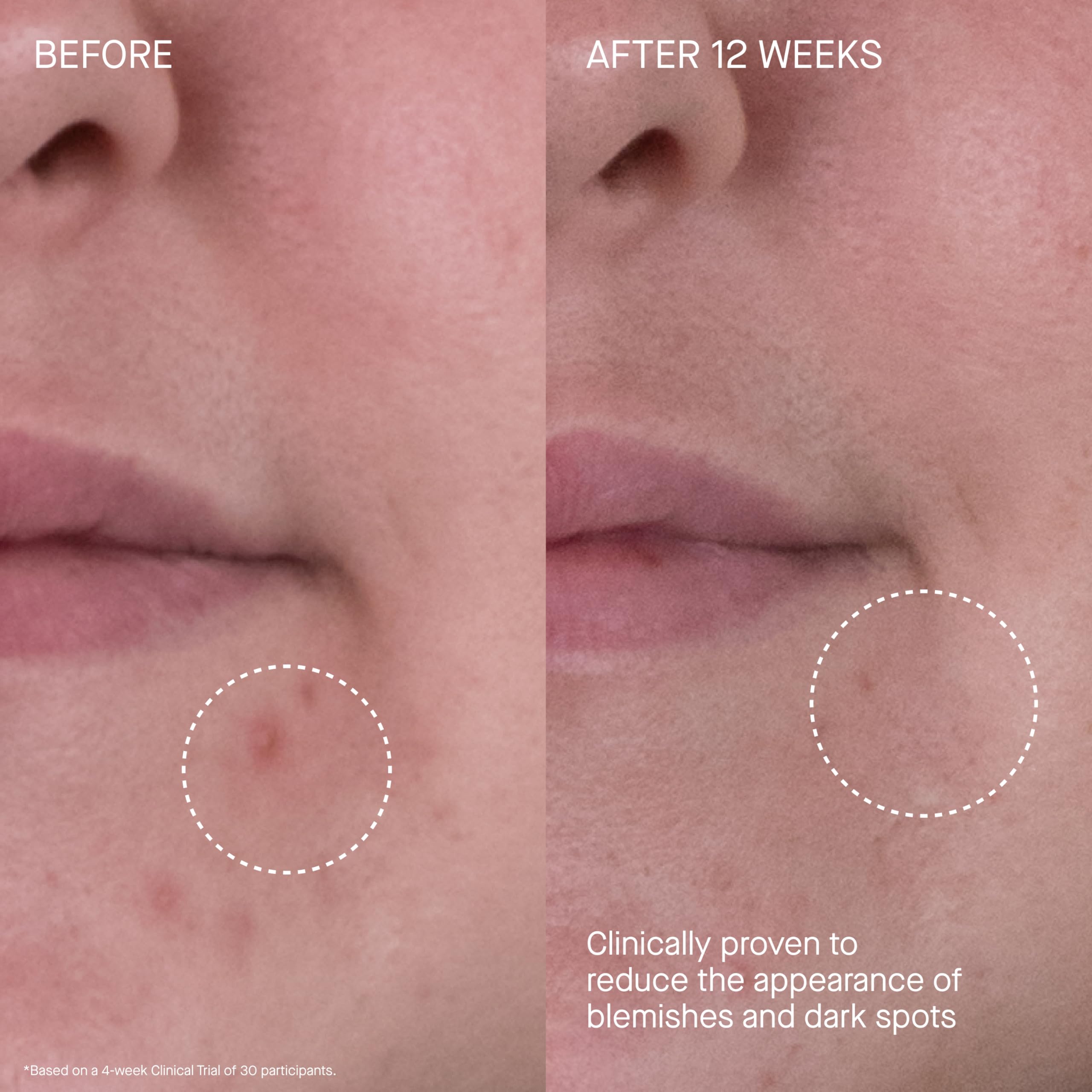 Rich Cream on neck and decollete for balanced hydration