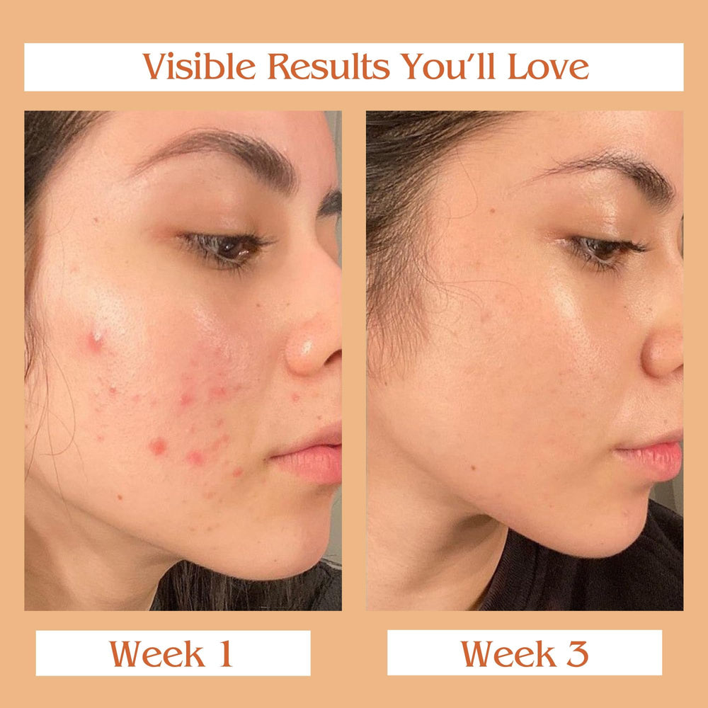 Auravedic Kumkumadi Oil all skin types image shows suitability for dry, oily, and sensitive skin.