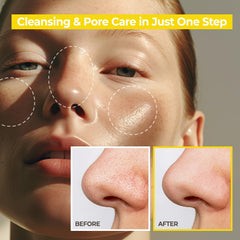 AVCA exfoliación suave con PHA, poros refinados con uso diario.
