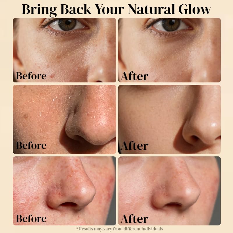 AveCera Tallow Balm on the face as moisturizer—gentle hydration