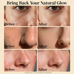 AveCera Tallow Balm on the face as moisturizer—gentle hydration