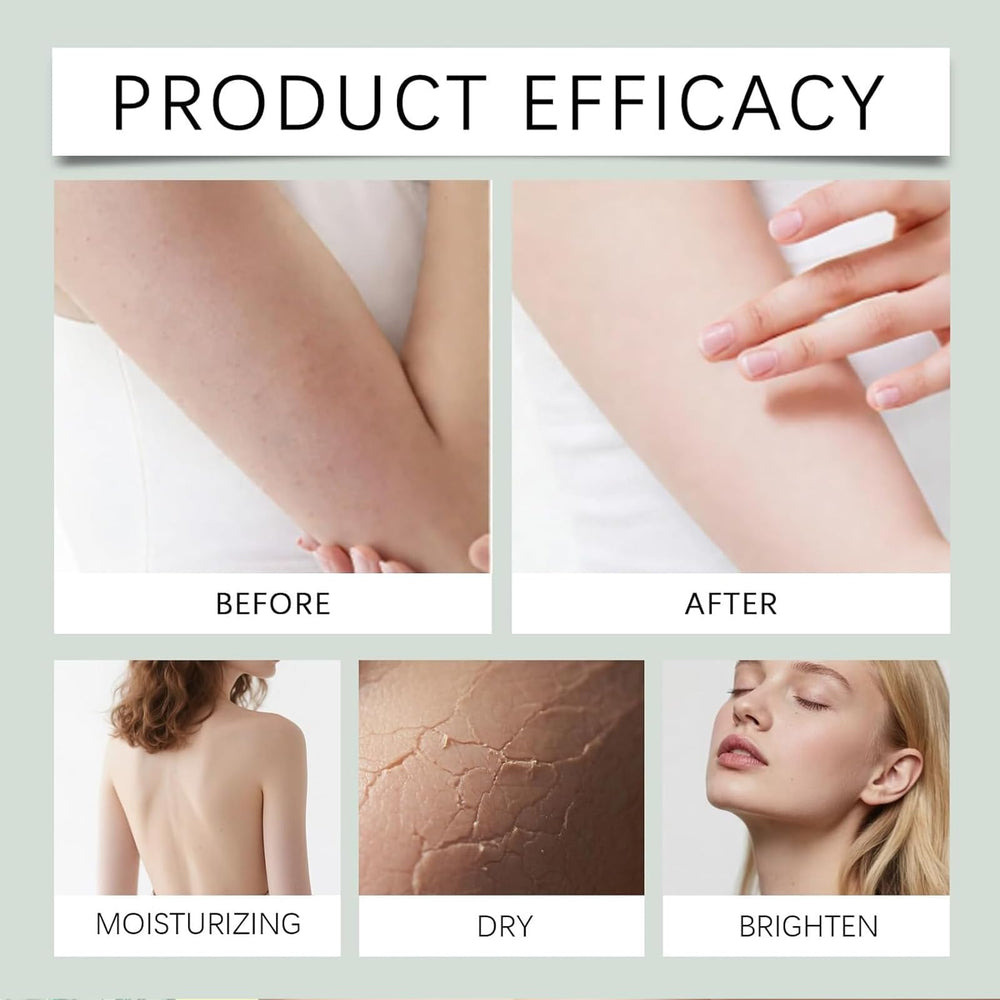 Ayland Healora Intertrigo: para áreas de pliegues con humedad frecuente.