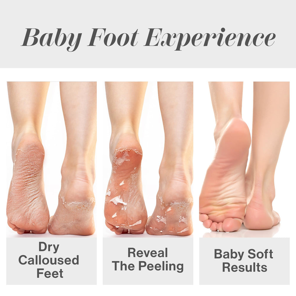 Close-up of feet after peel showing smoother skin.