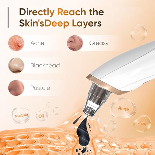 BAIIKO Blackhead Remover Vacuum showing three suction levels for customizable cleansing.