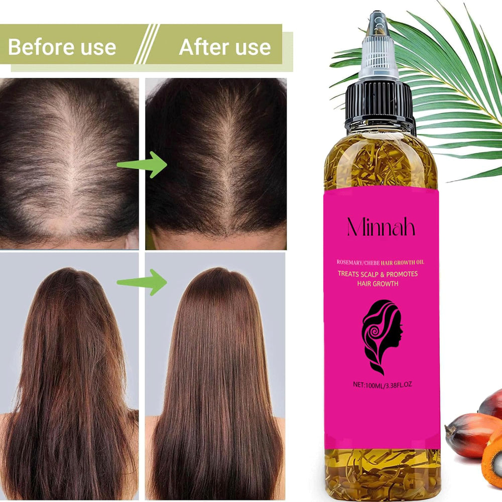BALPPRD Minnah Batana, cabello más nutrido tras cada uso.