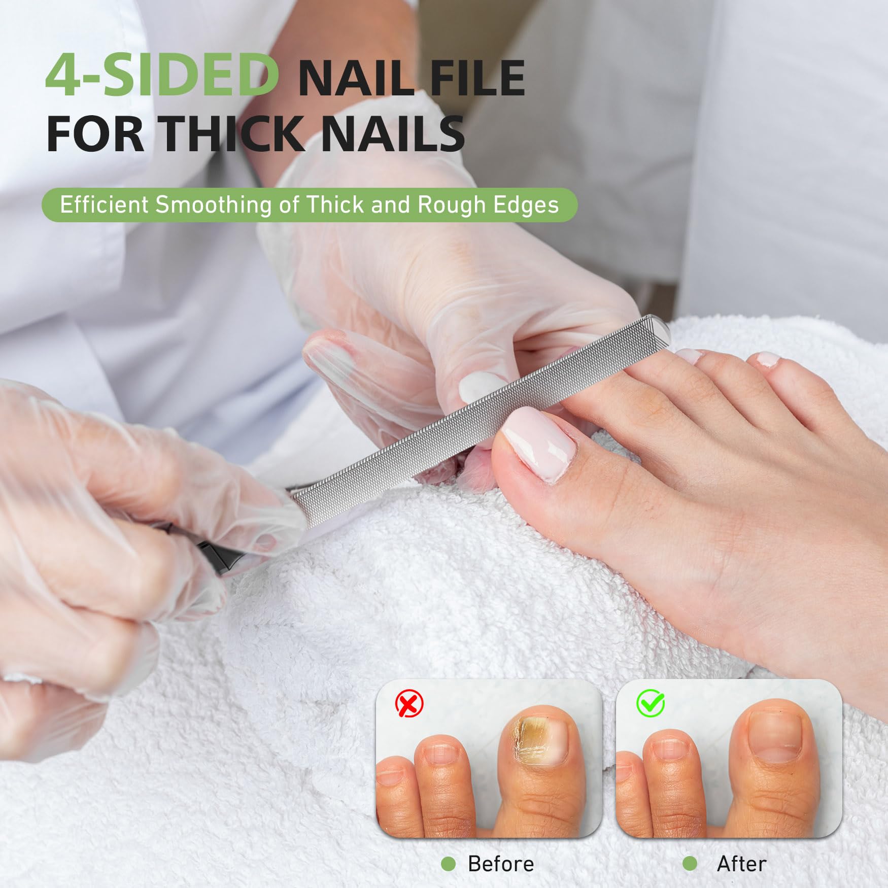 Baluca ingrown-nail lifter tool eases lifting and cleaning.