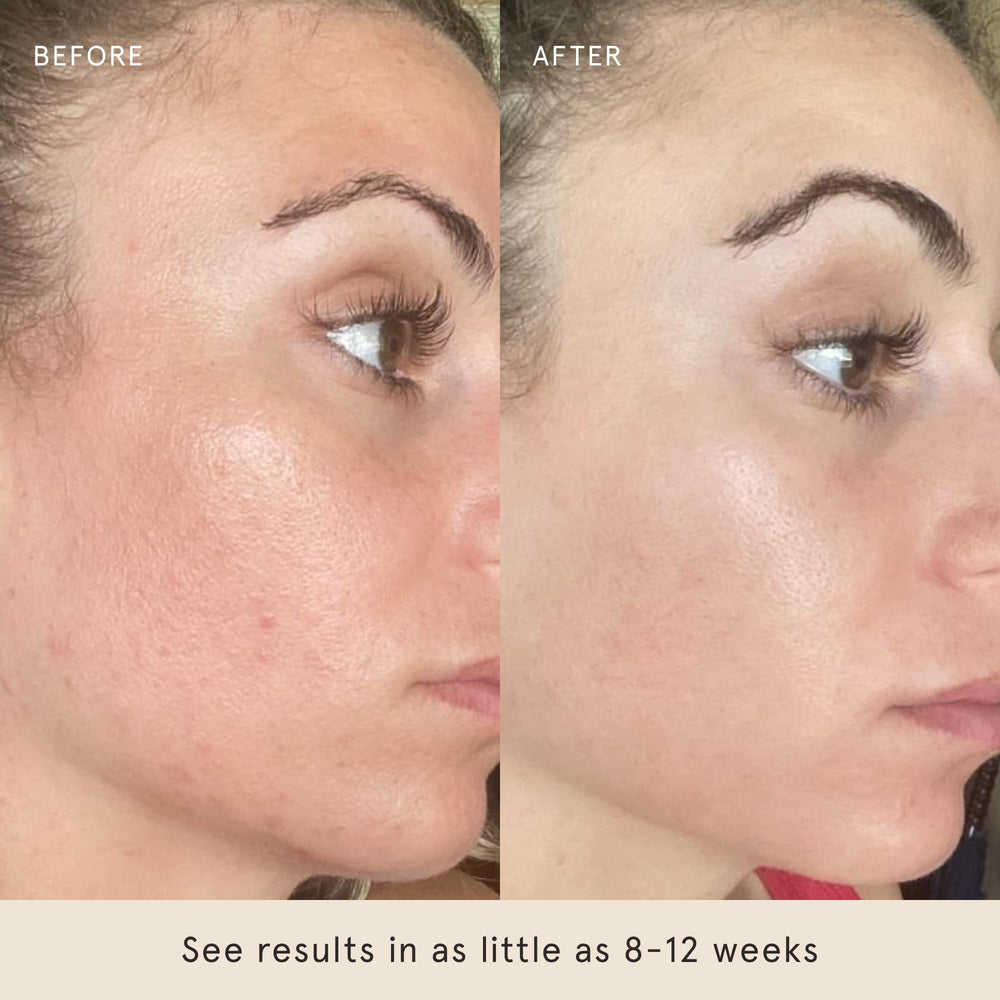 Barefaced Liquid Gold hyaluronic acid icon emphasizes hydration