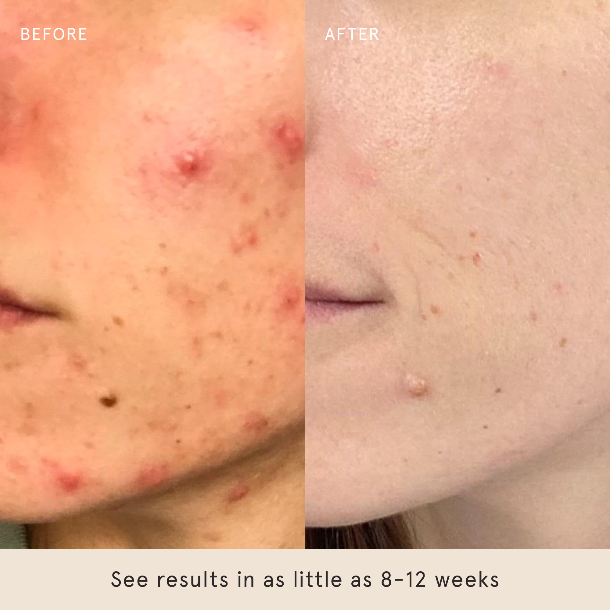Barefaced Toning Pads II application on forehead for even tone