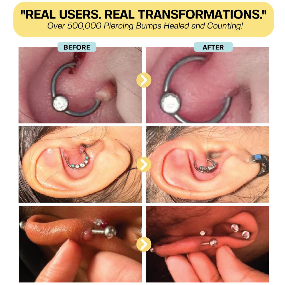 BASE LABORATORIES Gel reducción bultos queloides, uso diario en perforaciones
