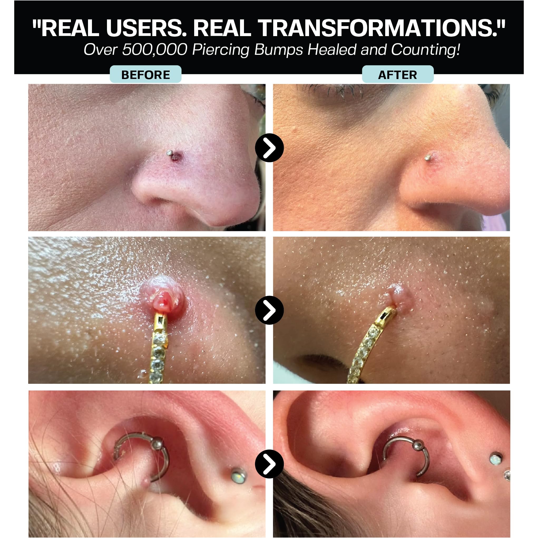 BASE LABORATORIES limpieza de piercing en nariz con solución salina