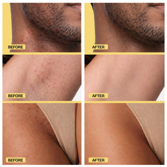 BASE LABORATORIES serum en botella para piel sensible sin irritación.