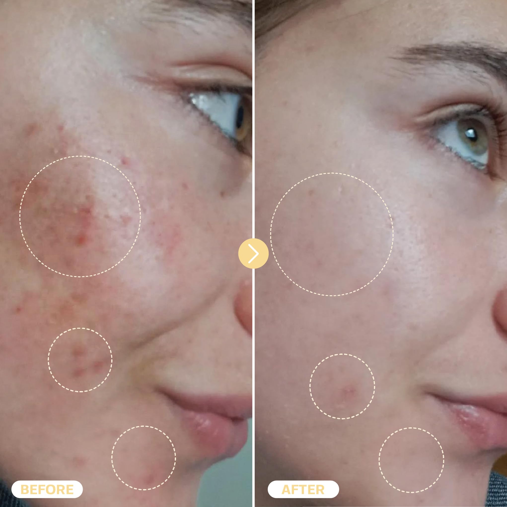 Base Laboratories HOCL spray para eczema, cuidado de piel sensible.
