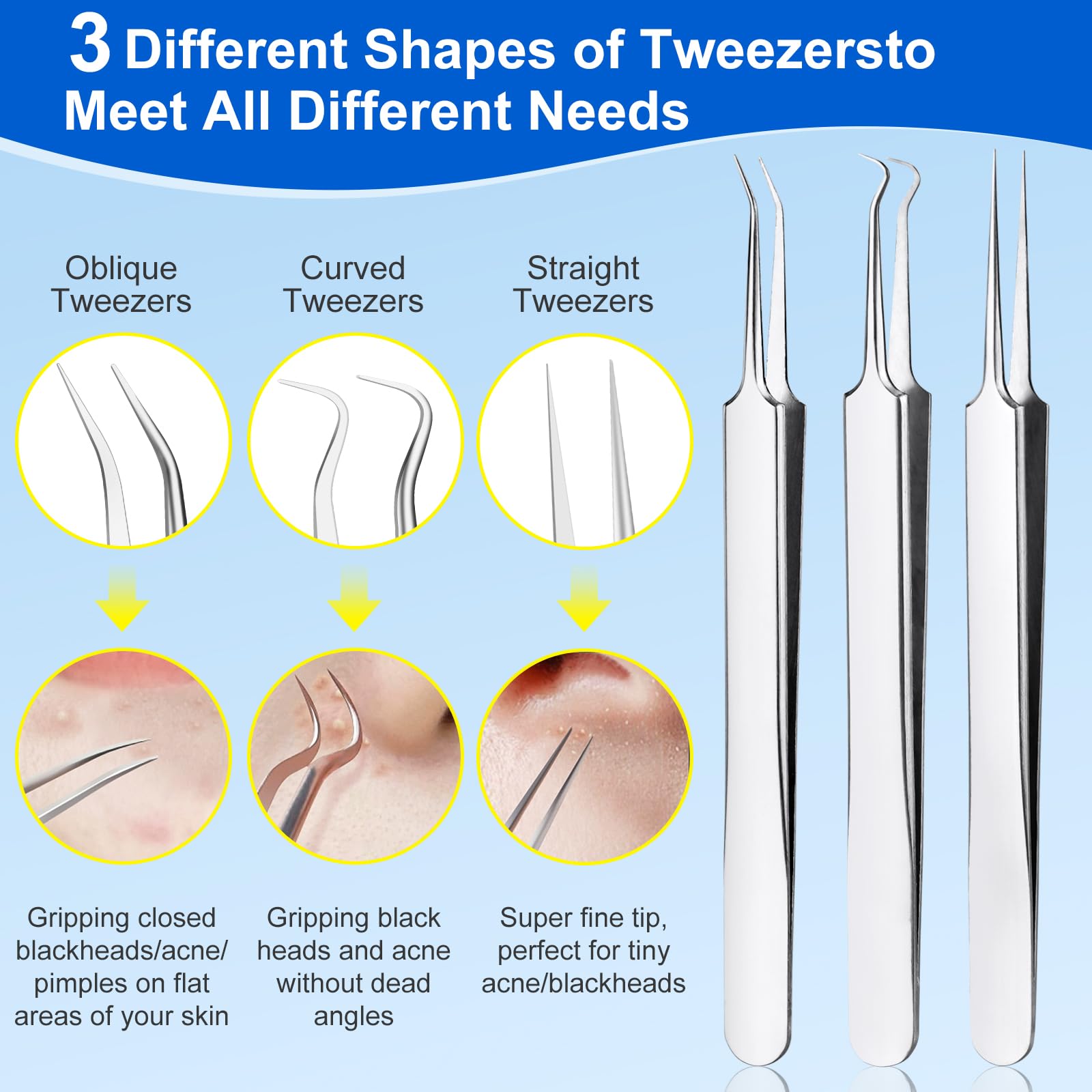 Baxrou 10-different-blackhead-remover-tools displayed for versatile at-home extraction.