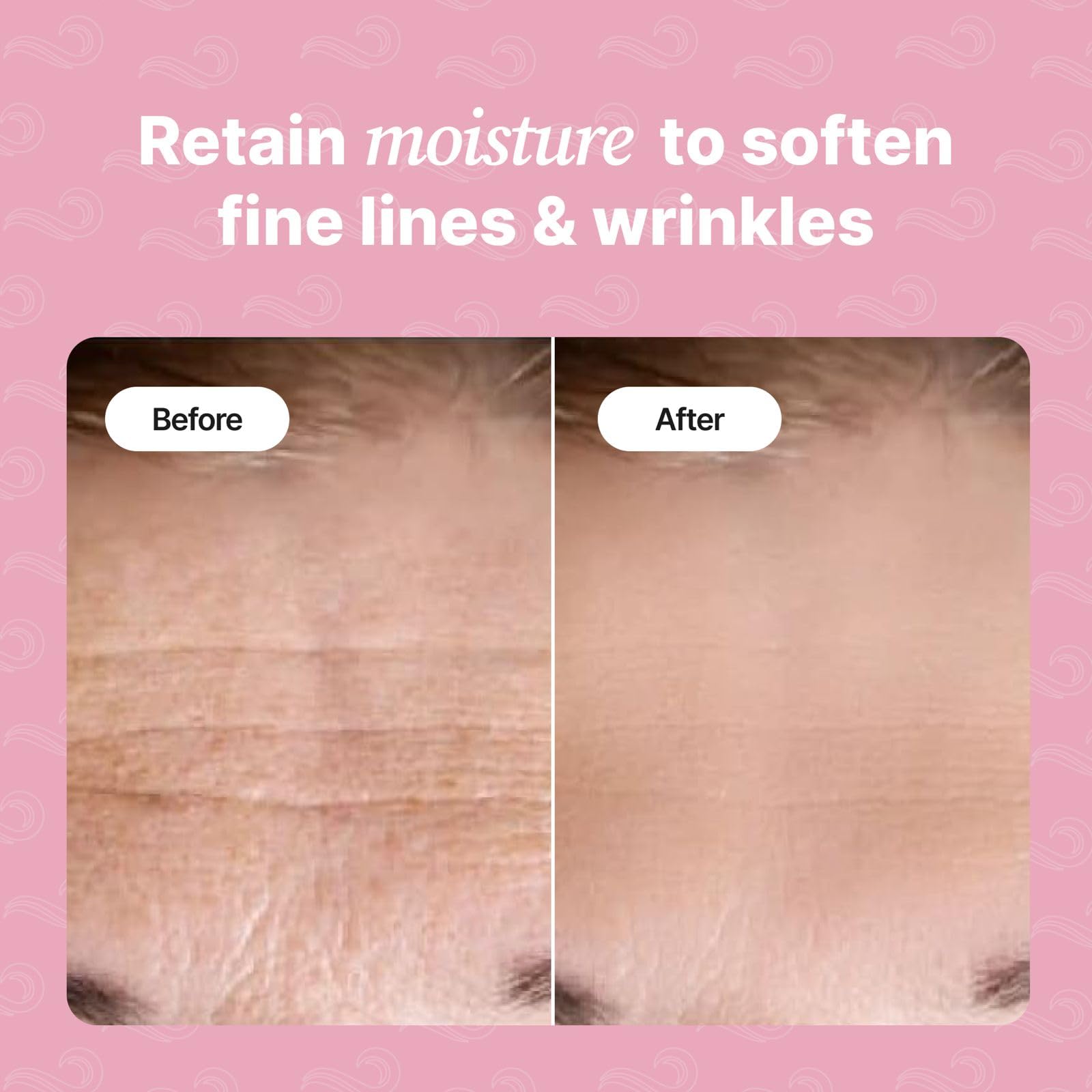 Bayside Forehead Wrinkle Patches applied to the forehead for overnight smoothing.