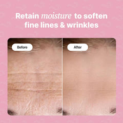 Bayside Forehead Wrinkle Patches applied to the forehead for overnight smoothing.