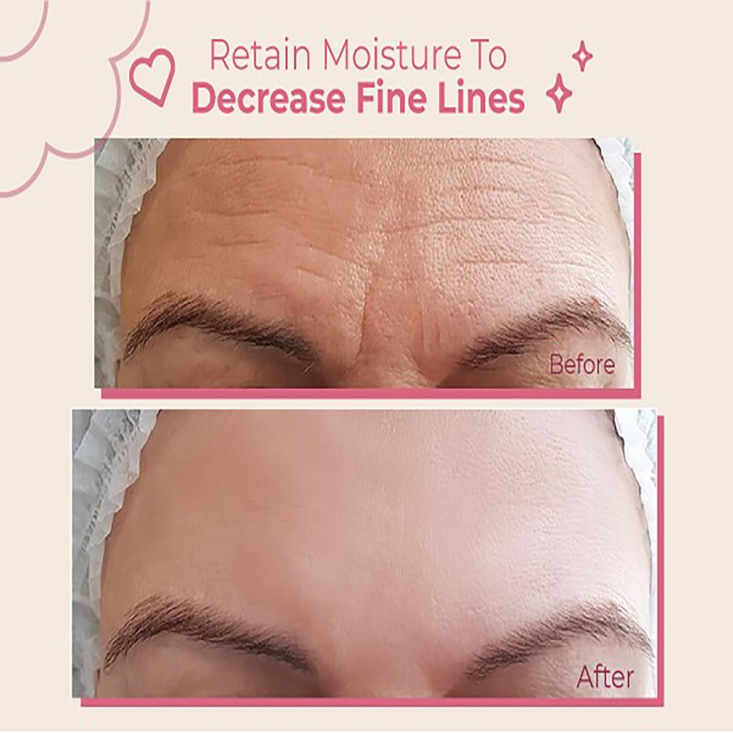 Bayside forehead wrinkle patches with reusable-material for comfortable night-time use.