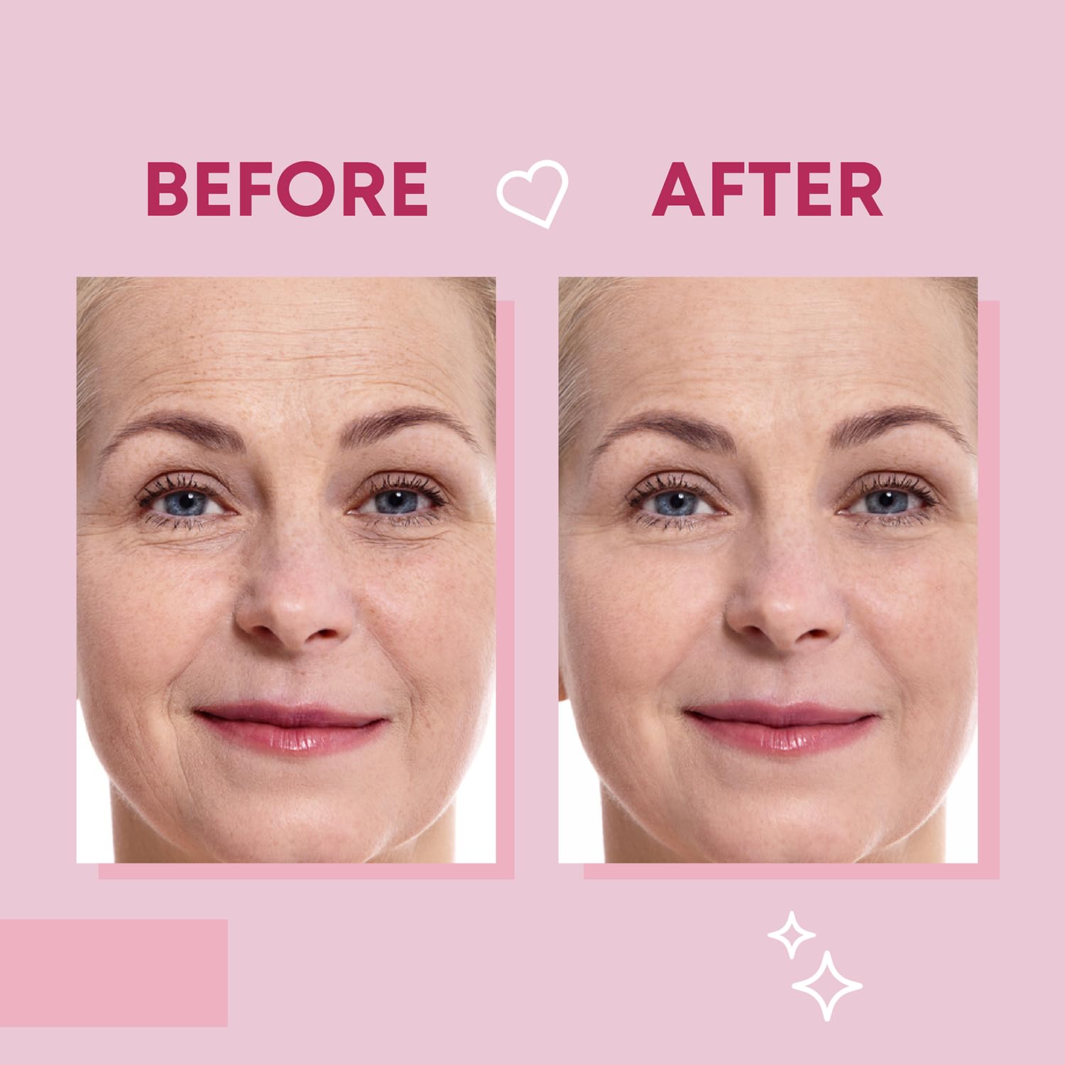 Parche Bayside con ácido hialurónico, aloe y vitamina E para cuidado facial.