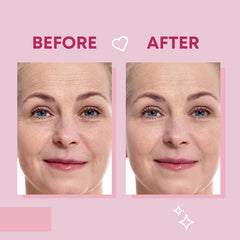 Parche Bayside con ácido hialurónico, aloe y vitamina E para cuidado facial.
