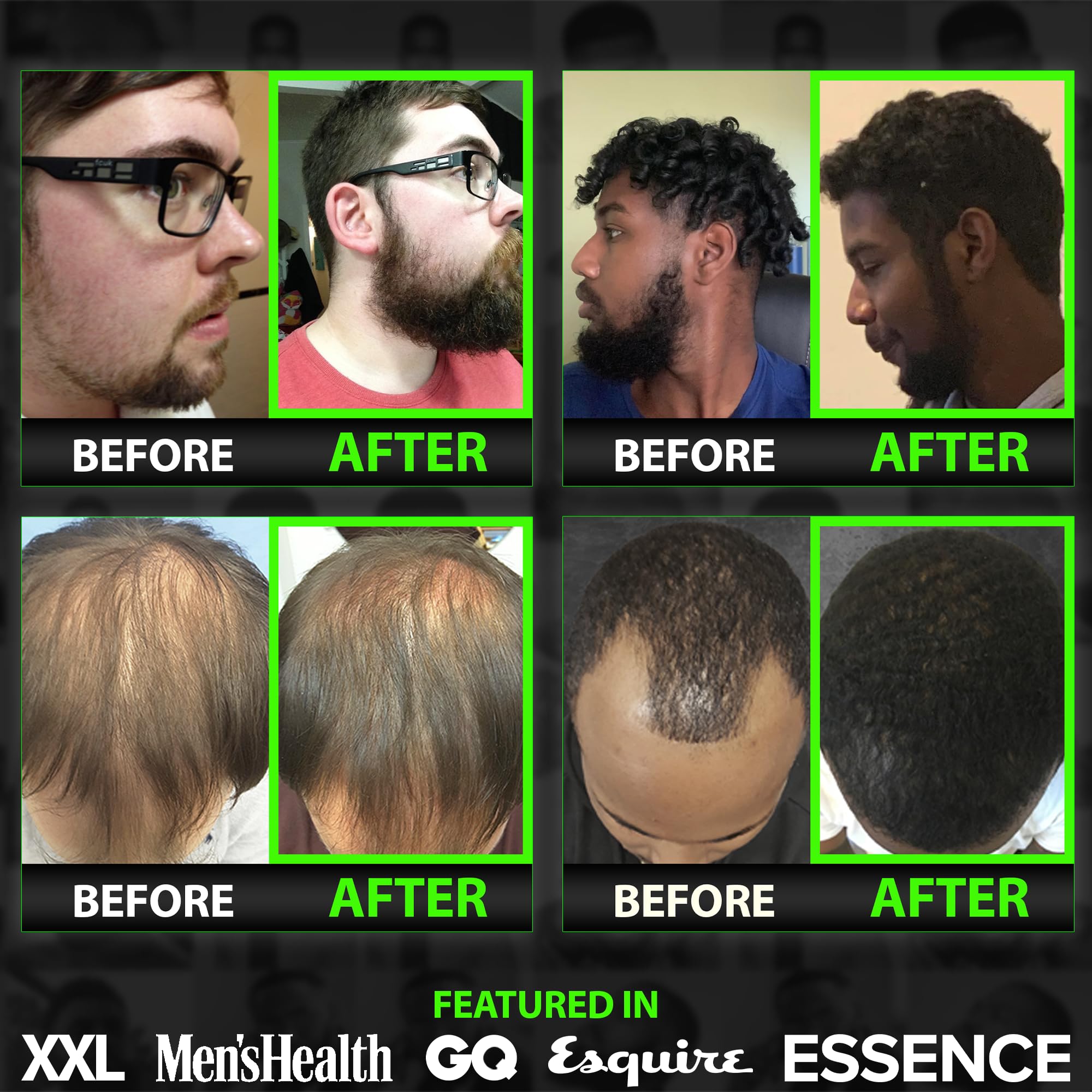 User styles beard with kit for a neat, confident shape