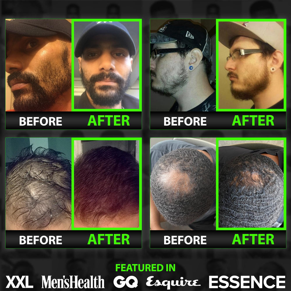 BBS Best Beard Stuff Grow beard application highlights even coverage and softening formula.