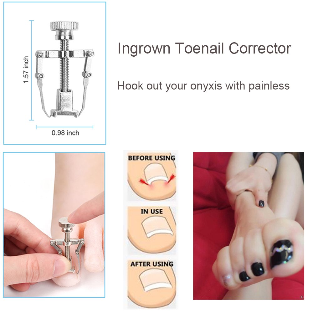 Bcabo ingrown toenail acne-needle supports careful skin work around the nail.