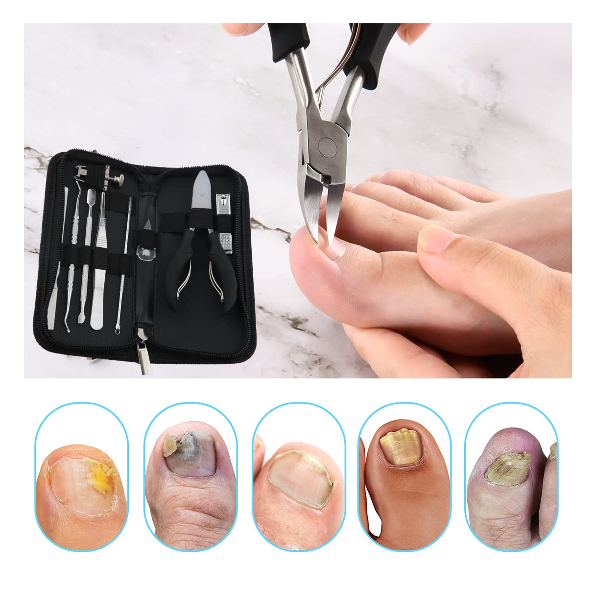 Bcabo ingrown toenail file smooths edges for comfortable nails.