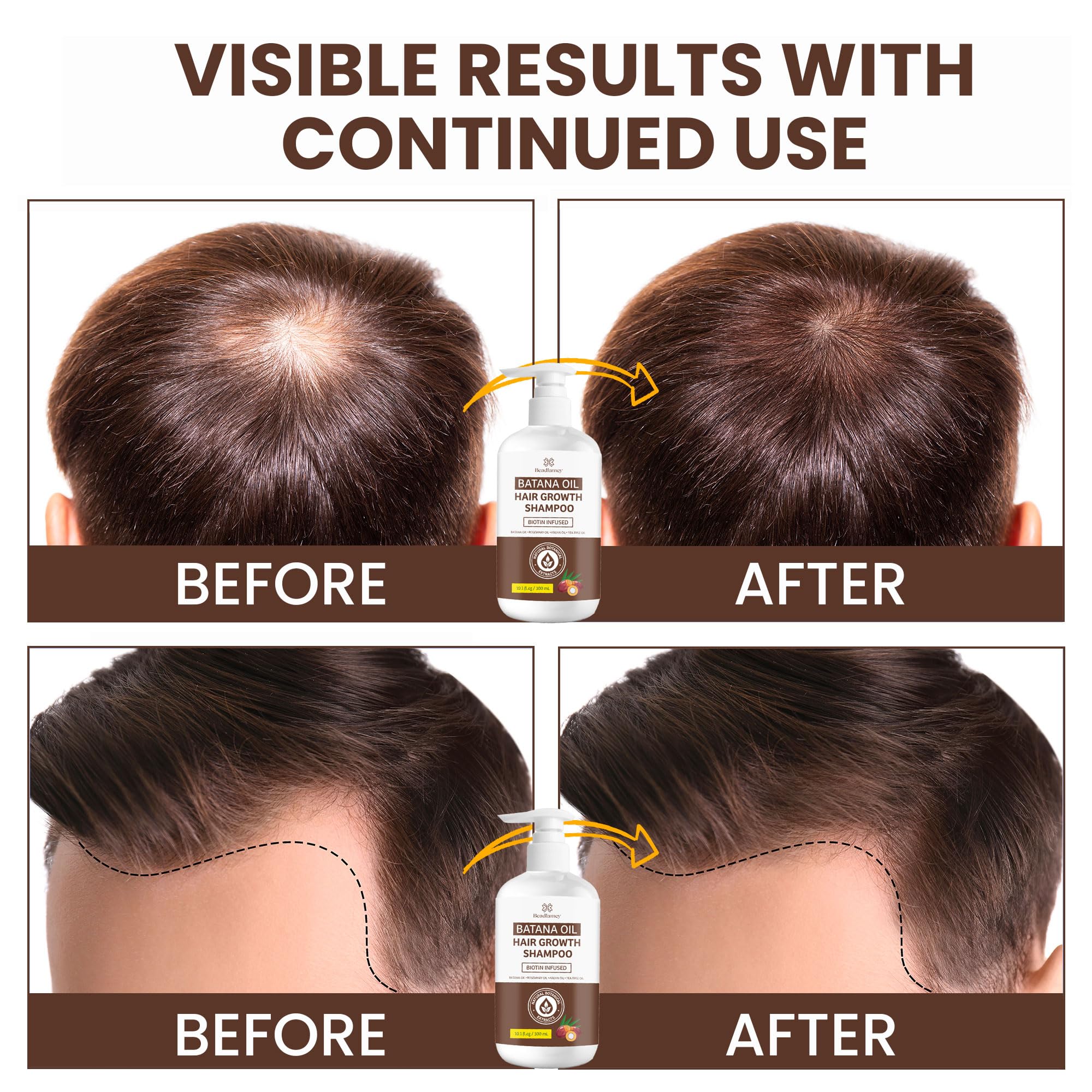 Beadlamey After-Workout Hair Refresh demonstrates post-exercise cleansing and revival.