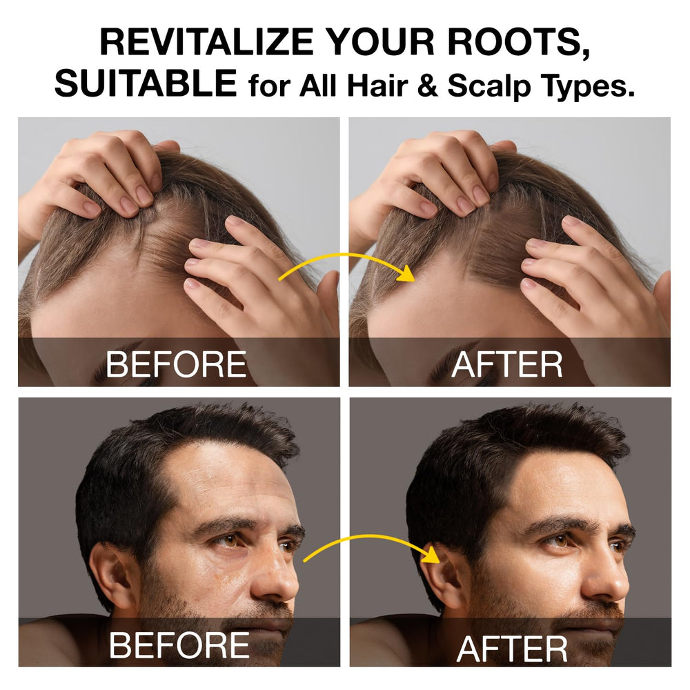 Beadlamey Root Activator Shampoo natural ingredients nourishing follicles.