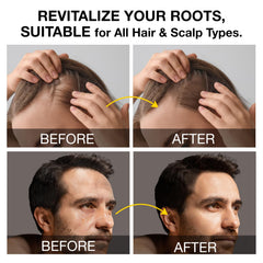 Beadlamey Root Activator Shampoo natural ingredients nourishing follicles.