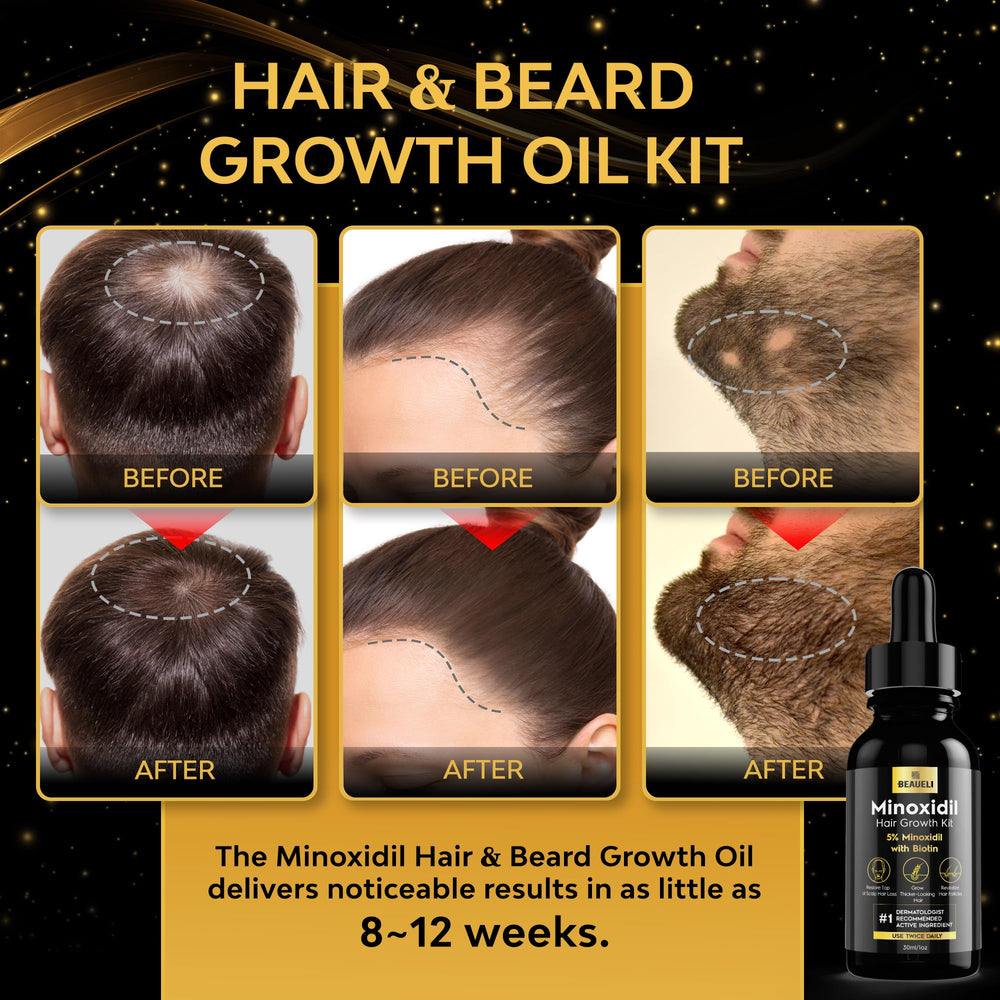 Beaueli Minoxidil 5% serum dropper for precise daily dosing.