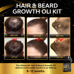 Beaueli Minoxidil beard growth kit serum application enables smooth, targeted treatment