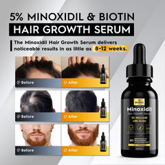 Beaueli Minoxidil dropper enables precise application to thinning areas.
