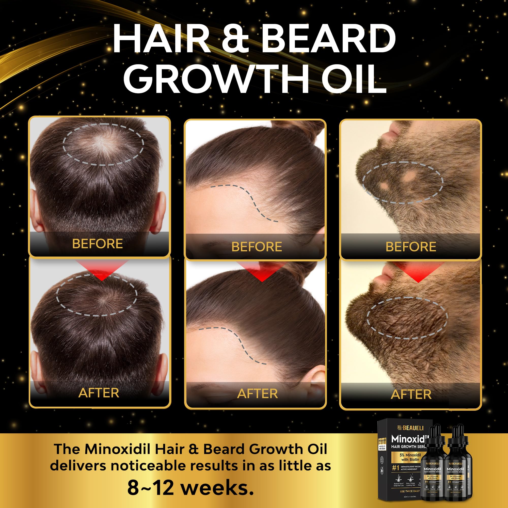 Beaueli minoxidil serum dropper close-up for precise, mess-free application.