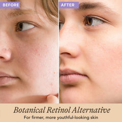 Beauty by Earth Bakuchiol Serum dropper releasing serum for easy nightly application