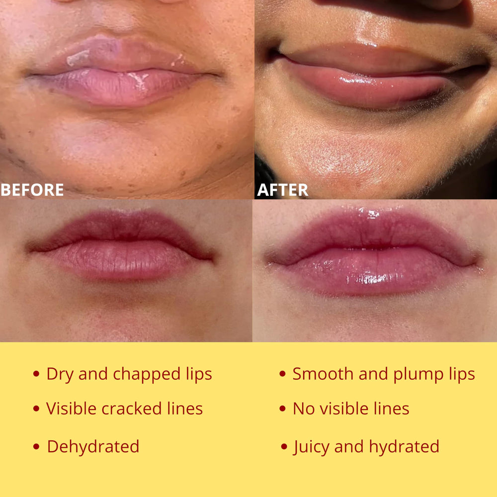 Miel e hidratación de Bee Balm Original para labios resecos.