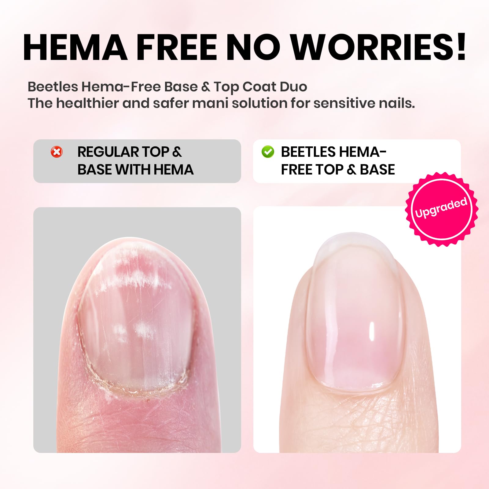 Beetles retirada fácil con acetona sin dañar las uñas.