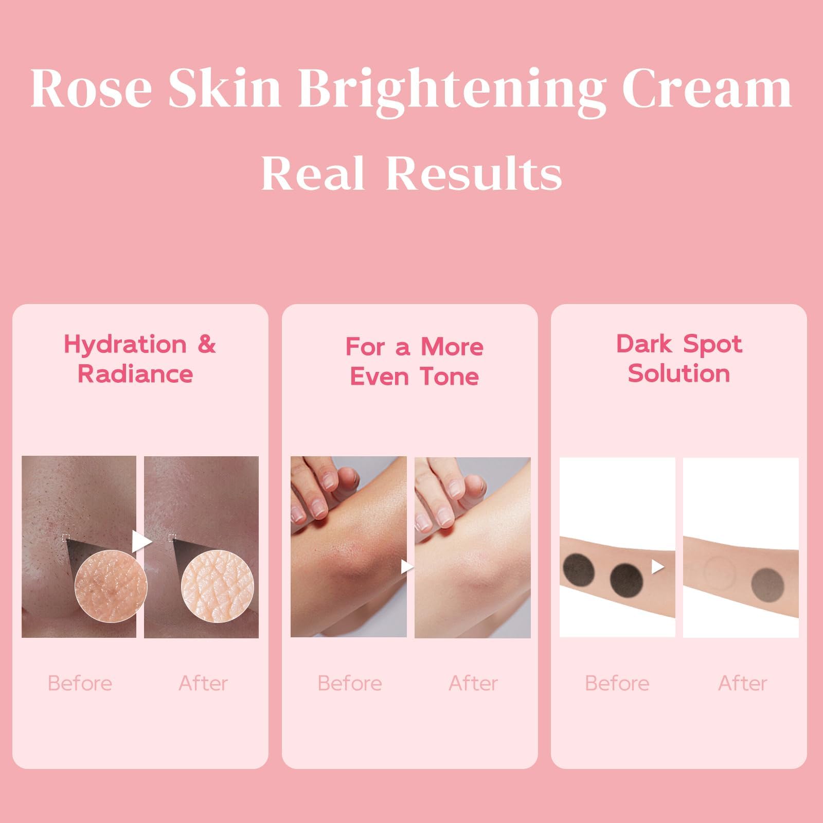BELIARST crema claridad piel rodillas oscuras para tono uniforme