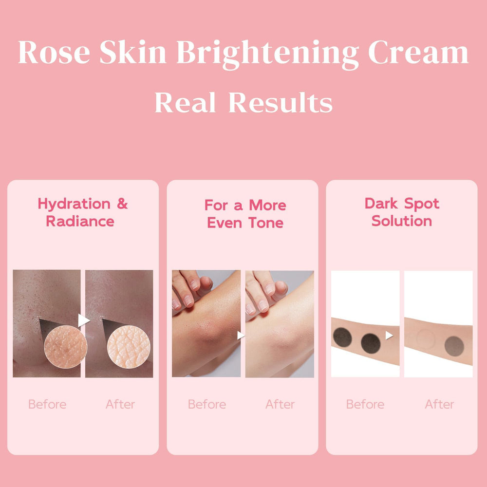 BELIARST crema claridad piel rodillas oscuras para tono uniforme