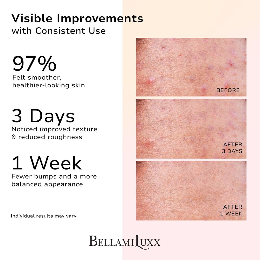 BellamiLuxx butt acne lotion tube smoothing rough patches