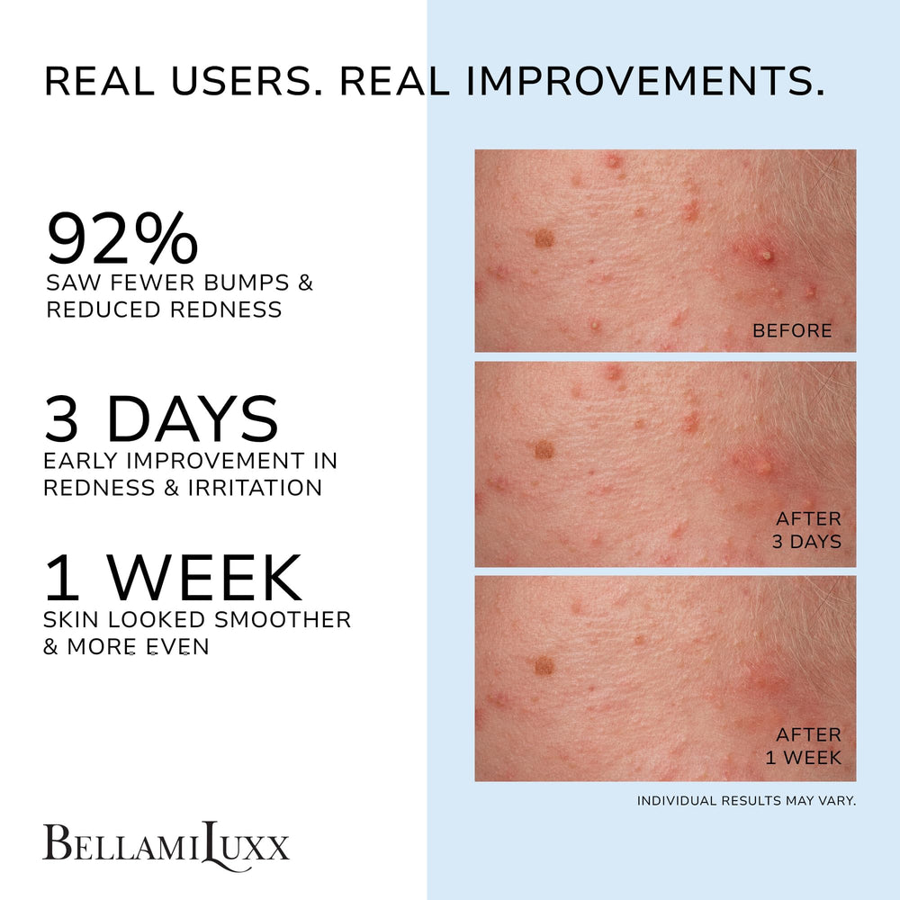 BellamiLuxx clarifying lotion texture spreads smoothly for quick absorption.