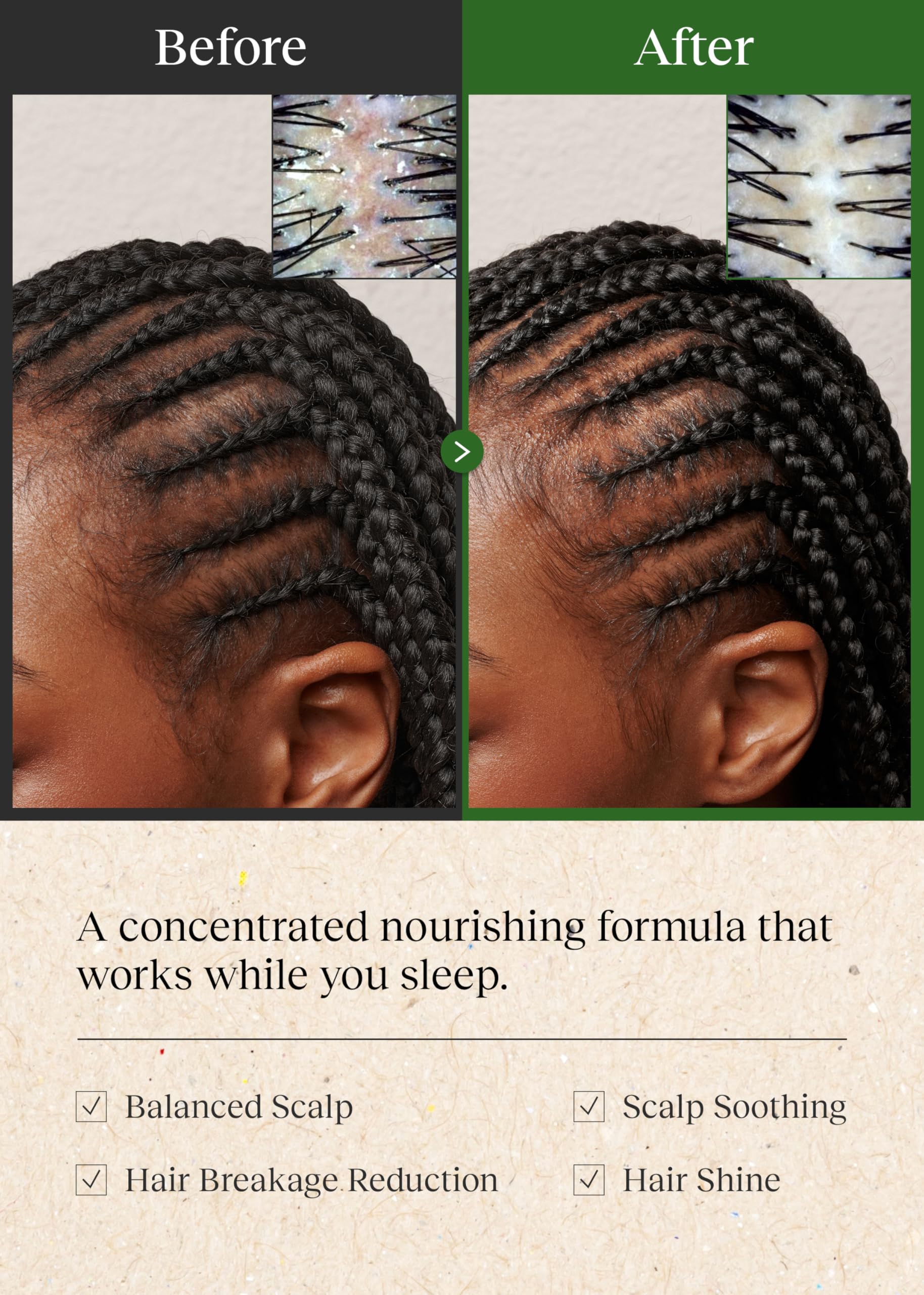 Bephor Braid Rev Balm scalp-massage during nightly routine