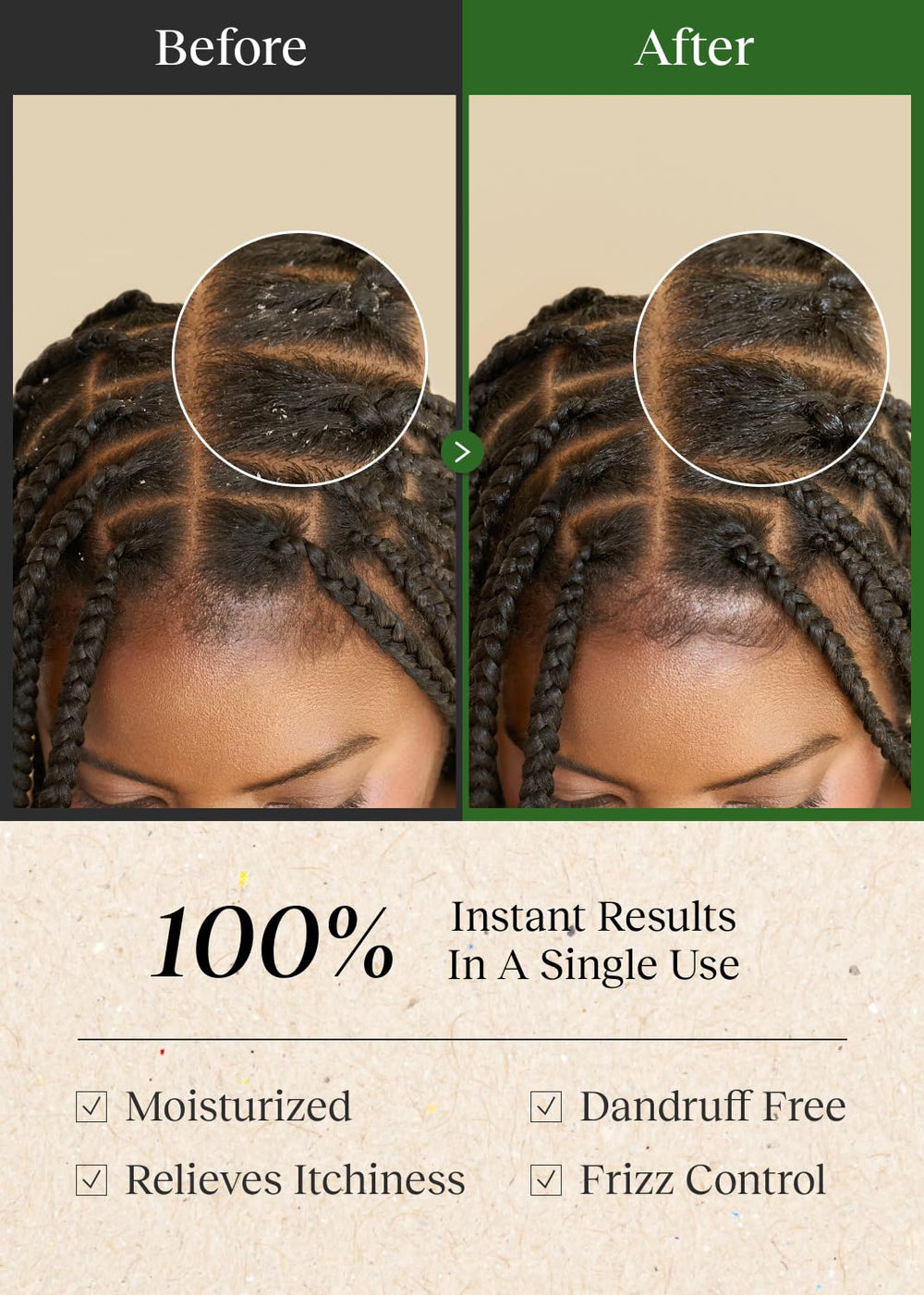 Bephor scalp toner refreshing spray near braids promotes balanced moisture